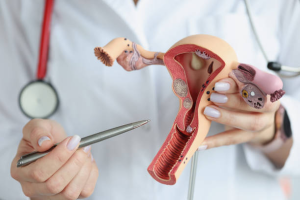 Gynaecological Issues